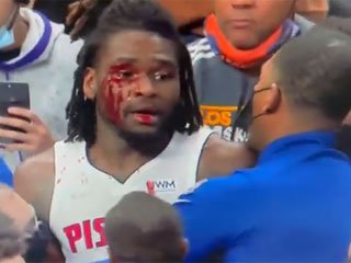 Леброн Джеймс был удален в матче с «Детройтом» за то, что намеренно разбил в кровь голову Айзейе Стюарту (Видео) - «БАСКЕТБОЛ»